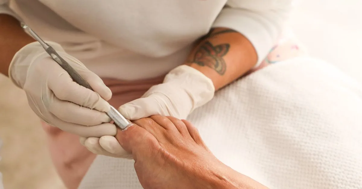 traitement des ongles mycosés à la lumière bleue : une méthode innovante et efficace pour éliminer les infections fongiques et retrouver des ongles sains.